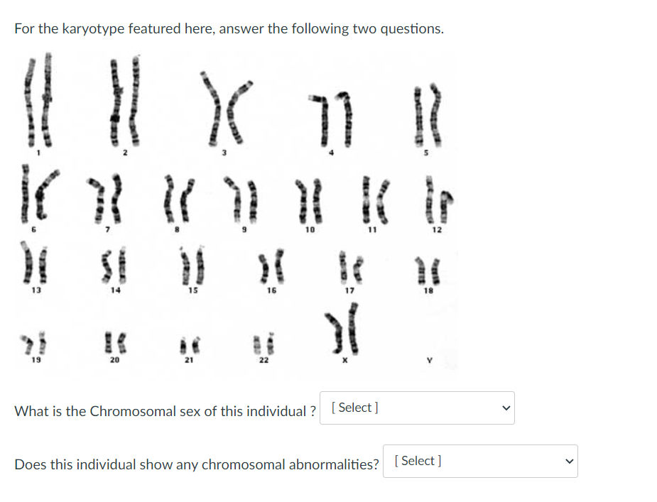 For the karyotype featured here, answer the following two questions.
10
12
13
14
15
16
17
18
19
20
21
22
What is the Chromosomal sex of this individual ? [ Select ]
Does this individual show any chromosomal abnormalities? [Select ]
>
>
