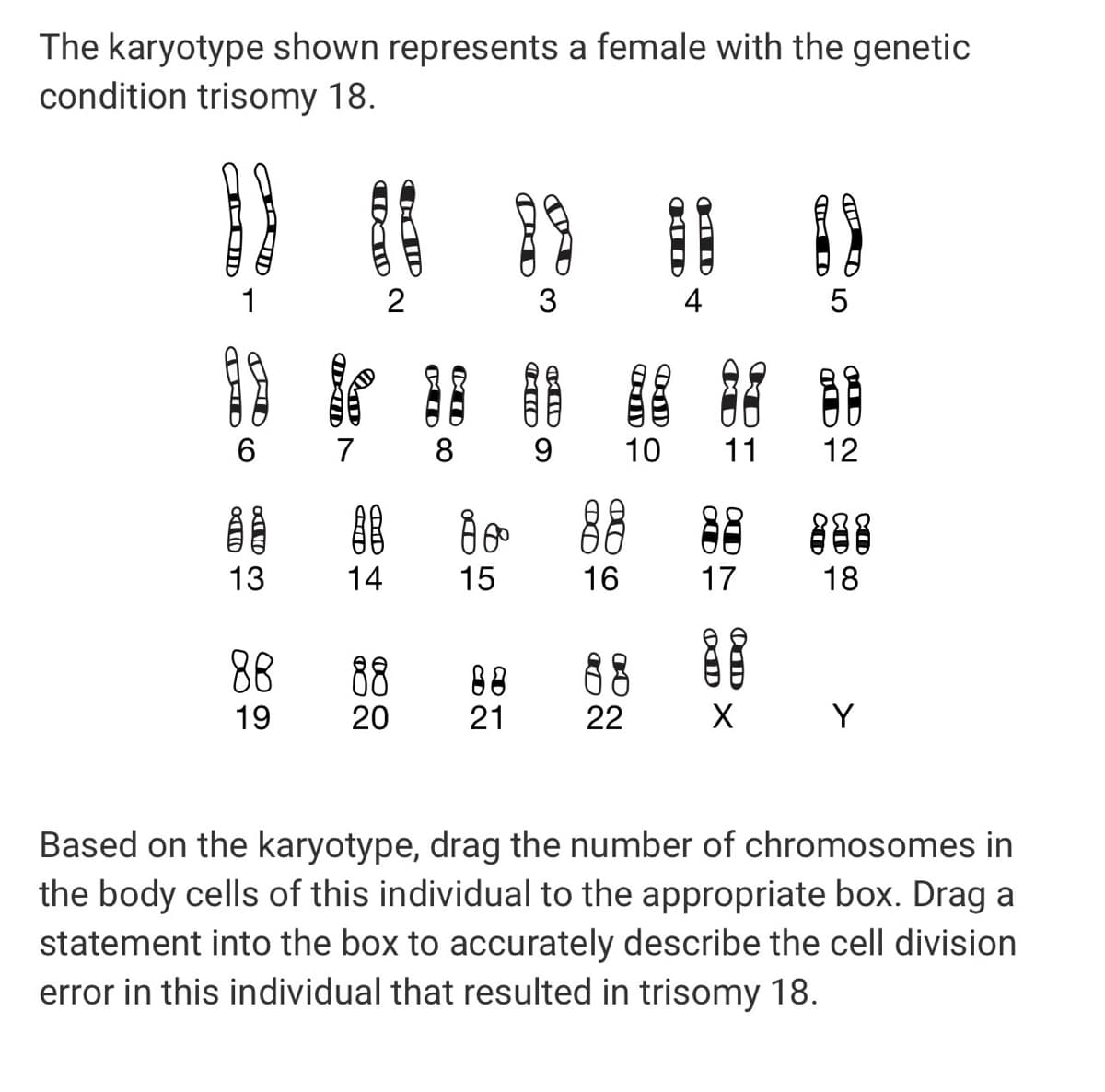 The karyotype shown represents a female with the genetic
condition trisomy 18.
1
2
4
5
目
6.
7
8
9.
10
11
12
13
14
15
16
17
18
88
88
88
88
19
20
21
22
Y
Based on the karyotype, drag the number of chromosomes in
the body cells of this individual to the appropriate box. Drag a
statement into the box to accurately describe the cell division
error in this individual that resulted in trisomy 18.
