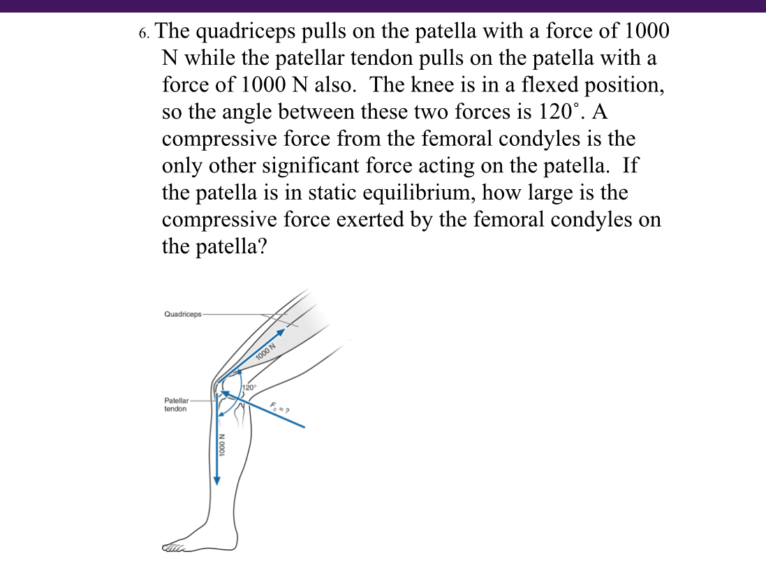 6. The quadriceps pulls on the patella with a force of 1000
N while the patellar tendon pulls on the patella with a
force of 1000 N also. The knee is in a flexed position,
so the angle between these two forces is 120°. A
compressive force from the femoral condyles is the
only other significant force acting on the patella. If
the patella is in static equilibrium, how large is the
compressive force exerted by the femoral condyles on
the patella?
Quadriceps
120
Patellar
tendon
Fe=?
V0001
