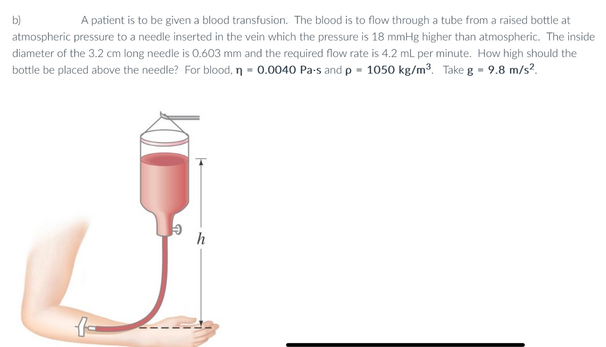 A patient is to be given a blood transfusion. The blood is to flow through a tube from a raised bottle at
atmospheric pressure to a needle inserted in the vein which the pressure is 18 mmHg higher than atmospheric. The inside
diameter of the 3.2 cm long needle is 0.603 mm and the required flow rate is 4.2 mL per minute. How high should the
bottle be placed above the needle? For blood, n = 0.0040 Pa-s and p = 1050 kg/m³. Take g = 9.8 m/s².