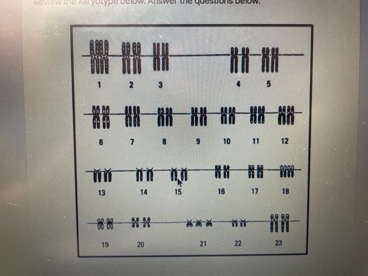 Review the karyoly
Answe
t計 計
講
6.
8.
6.
10
11 12
首 一
9000
前
13
14
15
16
17
18
19
20
21
22
23
