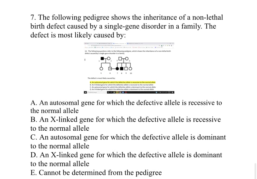 7. The following pedigree shows the inheritance of a non-lethal
birth defect caused by a single-gene disorder in a family. The
defect is most likely caused by:
