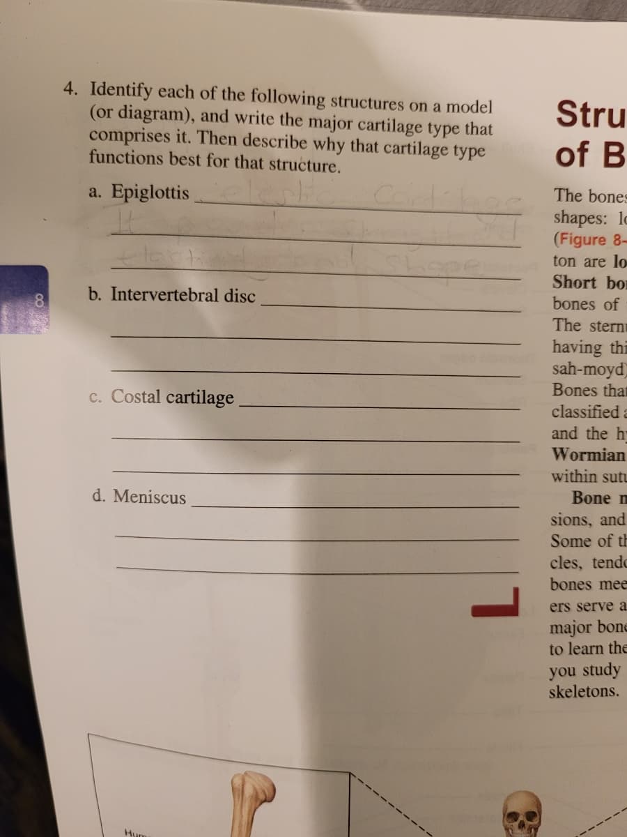 4. Identify each of the following structures on a model
(or diagram), and write the major cartilage type that
comprises it. Then describe why that cartilage type
functions best for that structure.
Stru
of B
a. Epiglottis
The bones
shapes: lo
(Figure 8-
ton are lo
Short bor
b. Intervertebral disc
bones of
The stern
having thi
sah-moyd)
Bones that
classified a
c. Costal cartilage
and the h
Wormian
within sutu
d. Meniscus
Bone m
sions, and
Some of th
cles, tendo
bones mee
ers serve a.
major bone
to learn the
you study
skeletons.
Hum
