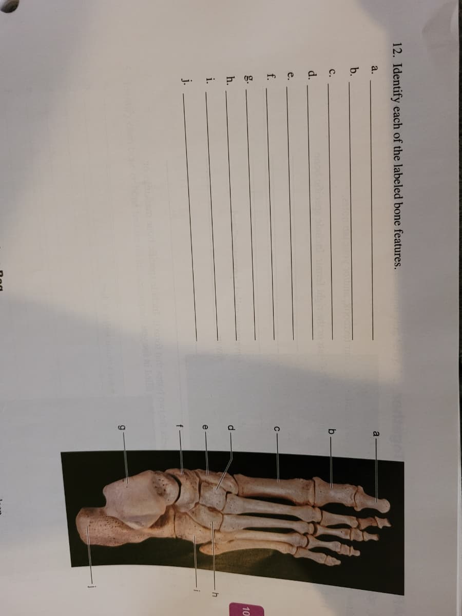 12. Identify each of the labeled bone features.
a.
a
b.
с.
d.
e.
f.
g.
10
h.
d
i.
e
j.
nod ows
