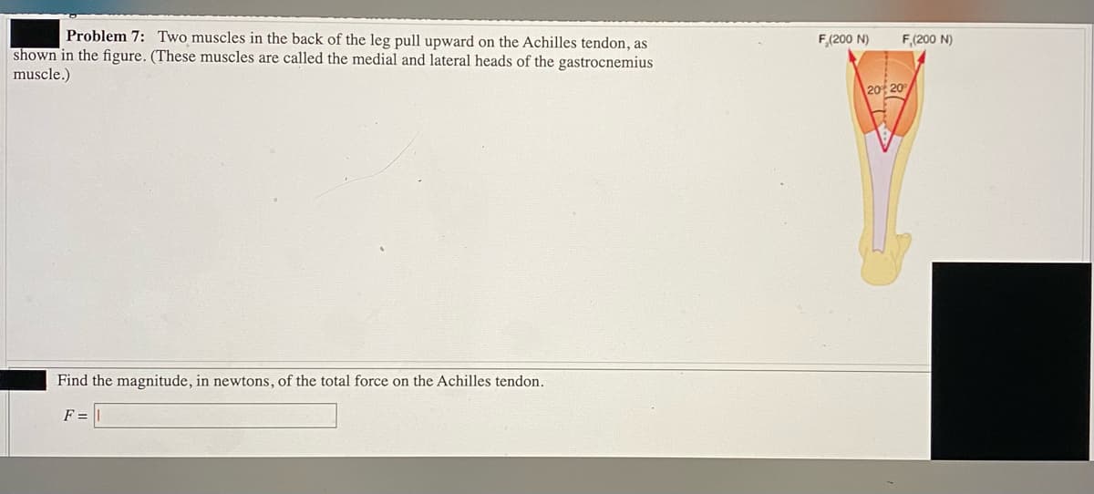 Problem 7: Two muscles in the back of the leg pull upward on the Achilles tendon, as
F,(200 N)
F,(200 N)
shown in the figure. (These muscles are called the medial and lateral heads of the gastrocnemius
muscle.)
20 20
Find the magnitude, in newtons, of the total force on the Achilles tendon.
F =
