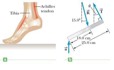 -Achilles
tendon
Tibia
15.0°
18.0 cm
25.0 cm
b.
