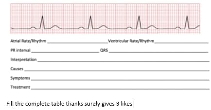 h
Atrial Rate/Rhythm,
Ventricular Rate/Rhythm
PR interval
QRS
Interpretation
Causes
Symptoms
Treatment
Fill the complete table thanks surely gives 3 likes|
