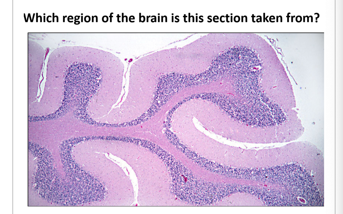 Which region of the brain is this section taken from?
