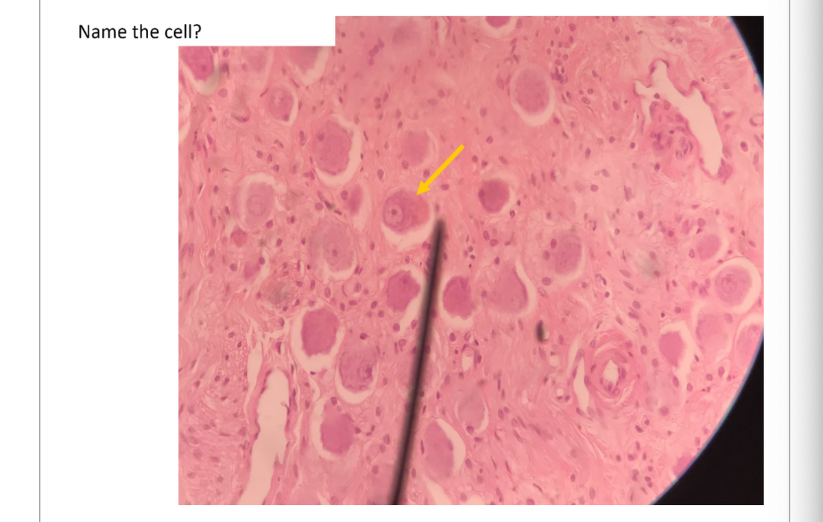 Name the cell?
