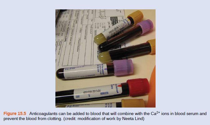 Figure 15.5 Anticoagulants can be added to blood that will combine with the Ca2+ ions in blood serum and
prevent the blood from clotting. (credit: modification of work by Neeta Lind)
Mainere
WIS
n Varutaine
T etie
FOR LLUNCE CLAMS

