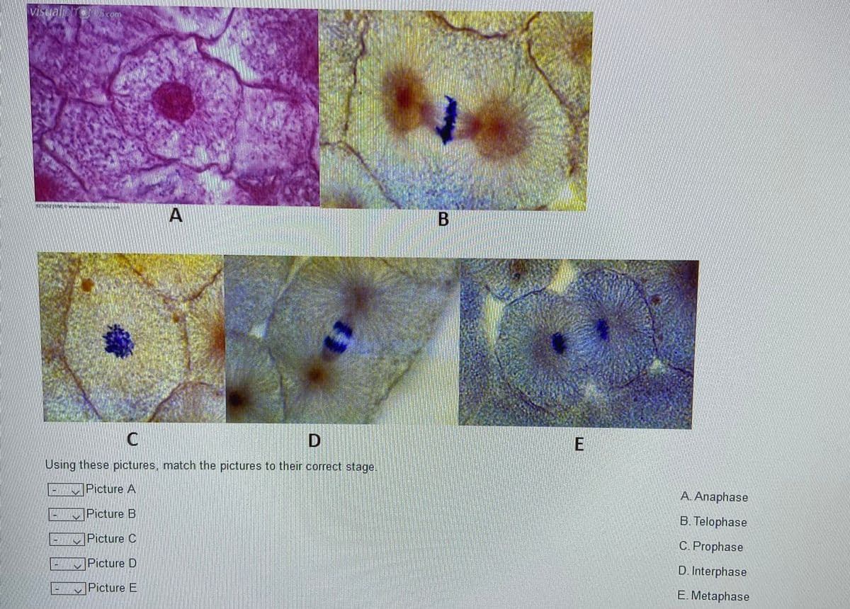 A
Using these pictures, match the pictures to their correct stage.
Picture A
A. Anaphase
Picture B
B. Telophase
LINPicture C
C. Prophase
Picture D
D. Interphase
Picture E
E. Metaphase
%3D
