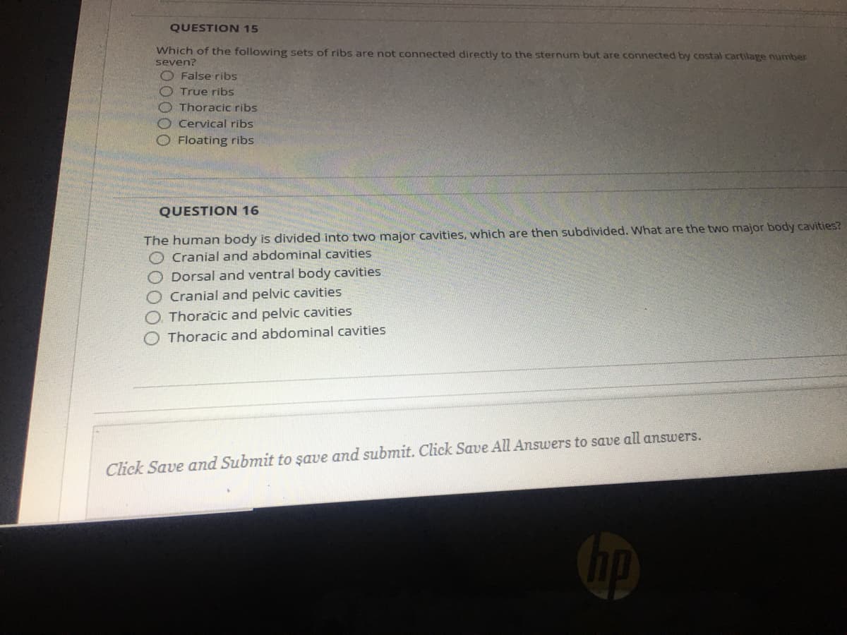 QUESTION 15
Which of the following sets of ribs are not connected directly to the sternum but are connected by costal cartilage number
seven?
O False ribs
OTrue ribs
O Thoracic ribs
Cervical ribs
O Floating ribs
QUESTION 16
The human body is divided into two major cavities, which are then subdivided. What are the two major body cavities?
O Cranial and abdominal cavities
O Dorsal and ventral body cavities
O Cranial and pelvic cavities
Thoracic and pelvic cavities
O Thoracic and abdominal cavities
Click Save and Submit to şave and submit. Click Save All Answers to save all answers.
