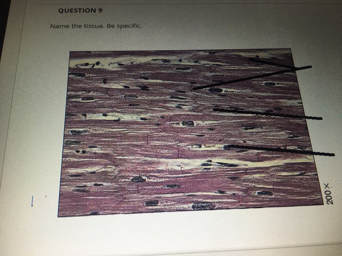 QUESTION 9
Name the tissue. Be specific.
x00
