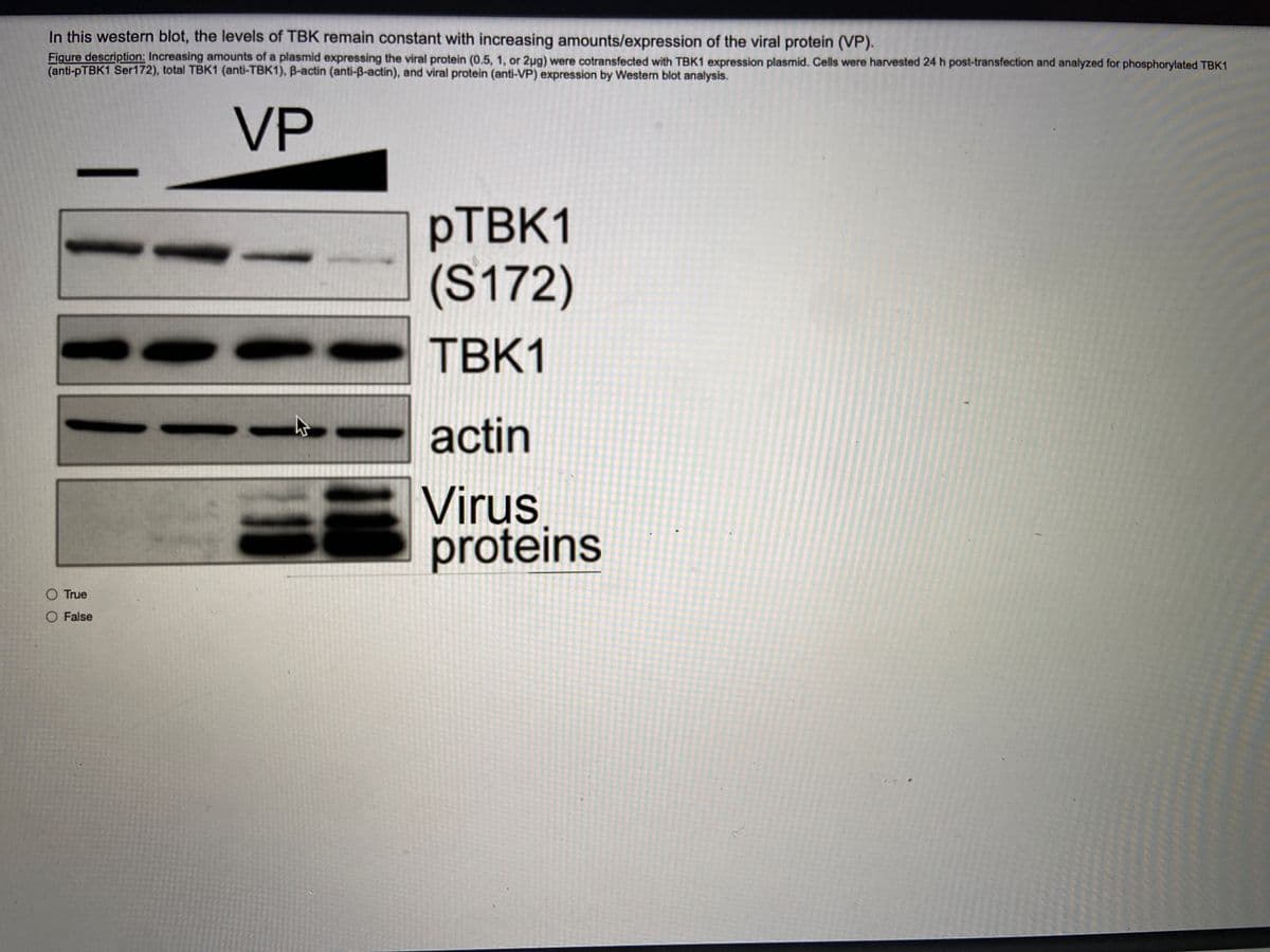 In this western blot, the levels of TBK remain constant with increasing amounts/expression of the viral protein (VP).
Figure description: Increasing amounts of a plasmid expressing the viral protein (0.5, 1, or 2ug) were cotransfected with TBK1 expression plasmid. Cells were harvested 24 h post-transfection and analyzed for phosphorylated TBK1
(anti-pTBK1 Ser172), total TBK1 (anti-TBK1), B-actin (anti-B-actin), and viral protein (anti-VP) expression by Western blot analysis.
VP
PTBK1
(S172)
TBK1
actin
Virus
proteins
O True
O False
