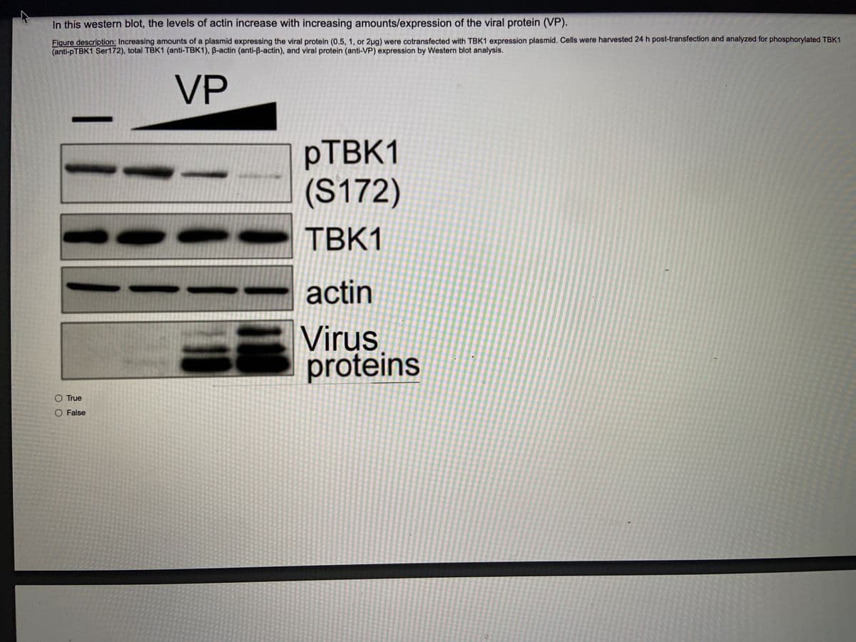 In this western blot, the levels of actin increase with increasing amounts/expression of the viral protein (VP).
Figure description: Increasing amounts of a plasmid expressing the viral protein (0.5, 1, or 2ug) were cotransfected with TBK1 expression plasmid. Cells were harvested 24 h post-transfection and analyzed for phosphorylated TBK1
(anti-PTBK1 Ser172), total TBK1 (anti-TBK1), B-actin (anti-ß-actin), and viral protein (anti-VP) expression by Western blot analysis.
VP
PTBK1
(S172)
TBK1
actin
Virus
proteins
O True
O False
