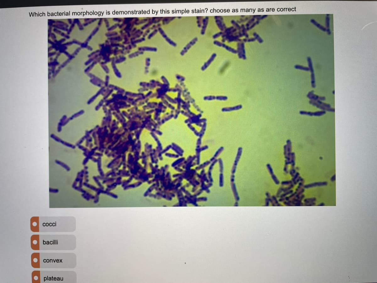 Which bacterial morphology is demonstrated by this simple stain? choose as many as are correct
cocci
• bacilli
convex
• plateau
