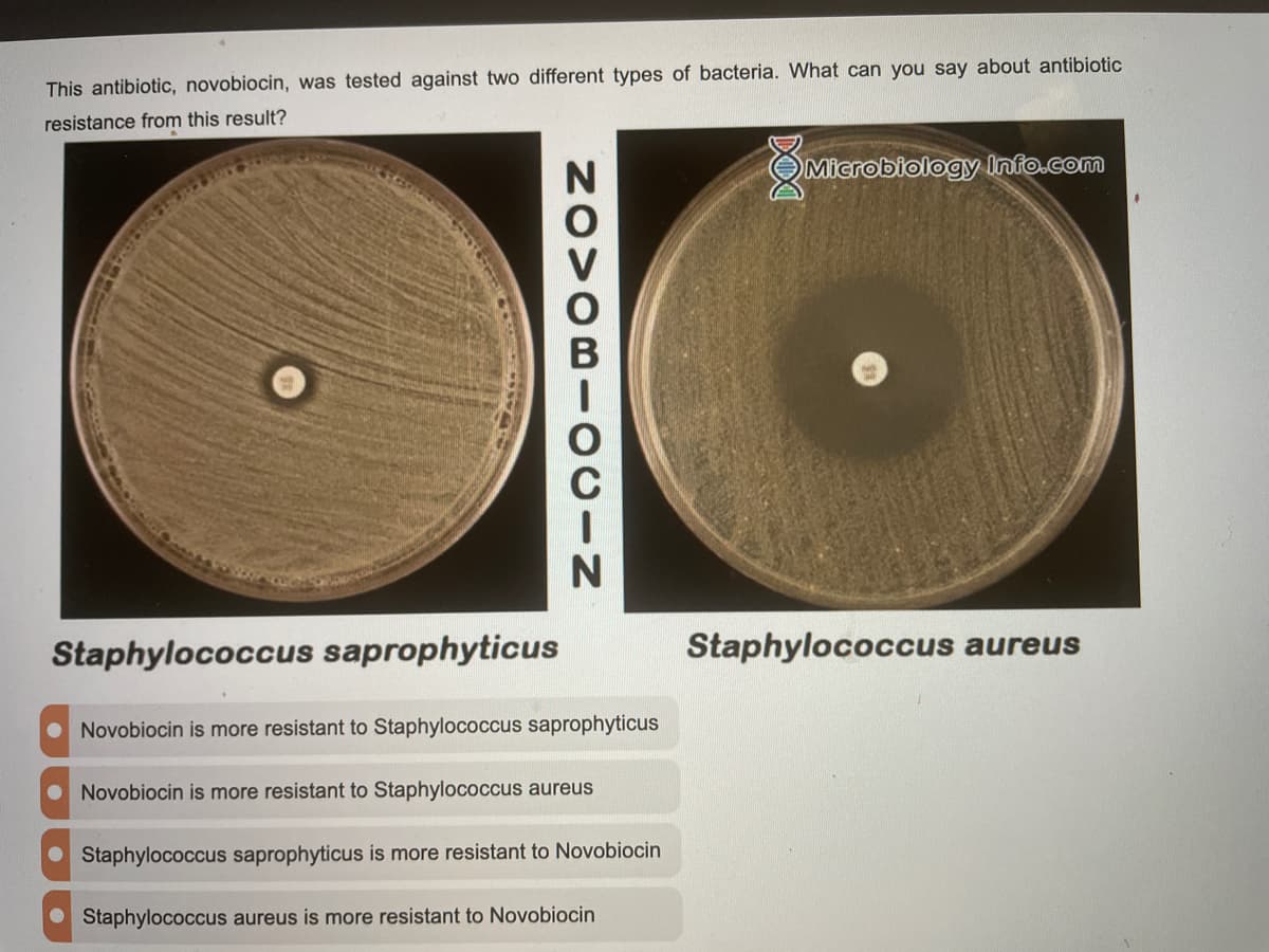 This antibiotic, novobiocin, was tested against two different types of bacteria. What can you say about antibiotic
resistance from this result?
OMicrobiology lnfo.com
Staphylococcus saprophyticus
Staphylococcus aureus
Novobiocin is more resistant to Staphylococcus saprophyticus
Novobiocin is more resistant to Staphylococcus aureus
Staphylococcus saprophyticus is more resistant to Novobiocin
Staphylococcus aureus is more resistant to Novobiocin
DO
NOVOBI- OCIN
