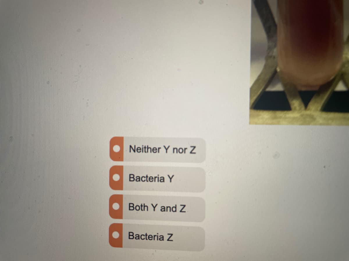Neither Y nor Z
Bacteria Y
Both Y and Z
Bacteria Z
