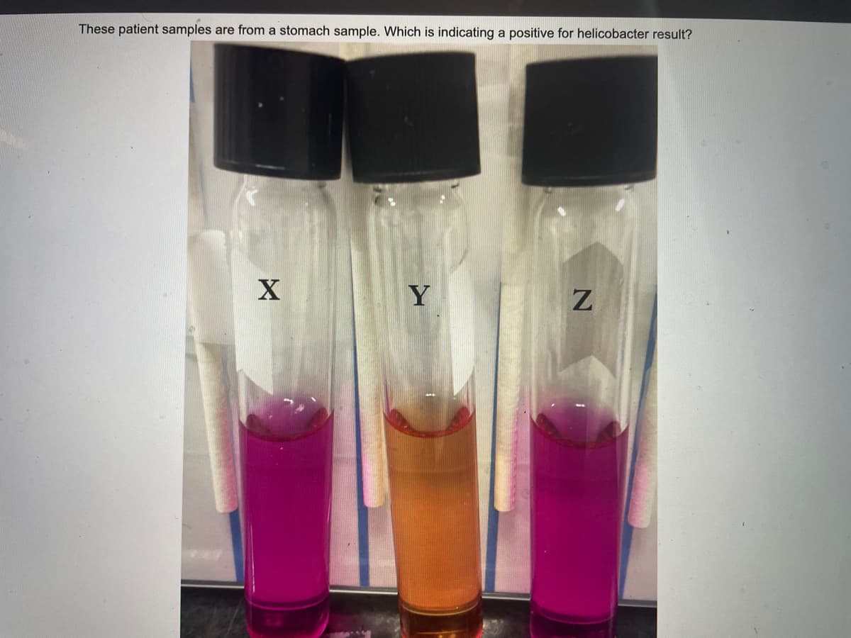 These patient samples are from a stomach sample. Which is indicating a positive for helicobacter result?
Y
