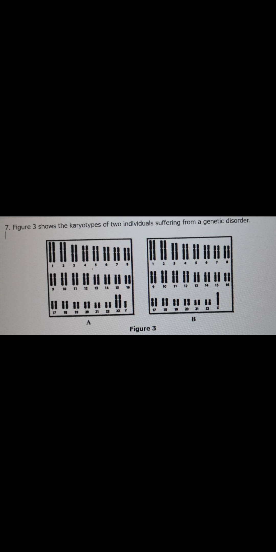7. Figure 3 shows the karyotypes of two individuals suffering from a genetic disorder.
10 11 12
13 14
15
17
19
22
XX Y
17
18
19
Figure 3
