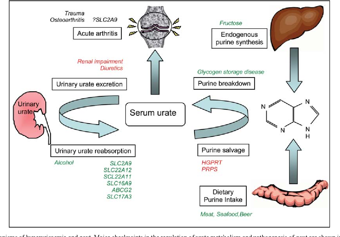 Trauma
Osteoarthritis
?SLC2A9
Fructose
Acute arthritis
Endogenous
purine synthesis
↑
Renal impairment
Diuretics
Glycogen storage disease
Urinary urate excretion
Purine breakdown
Urinary
urater
Serum urate
H.
Urinary urate reabsorption
Purine salvage
Alcohol
SLC2A9
HGPRT
SLC22A12
PRPS
SCL22A11
SLC16A9
ABCG2
SLC17A3
Dietary
Purine Intake
Meat, Seafood,Beer
