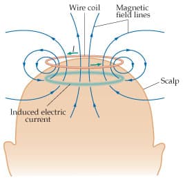Wire coil
Magnetic
field lines
Scalp
Induced electric
current
