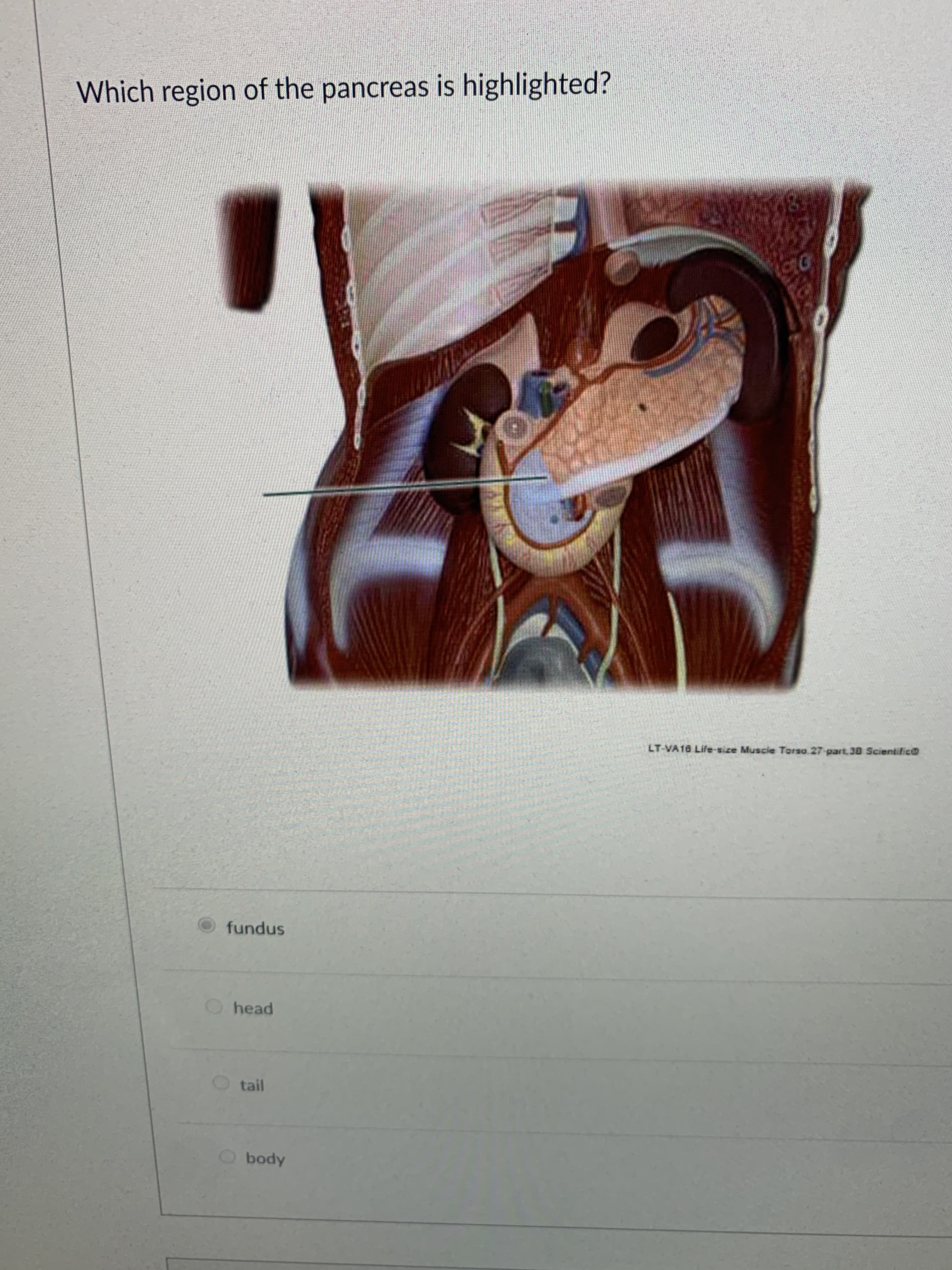 Which region of the pancreas is highlighted?
LT-VA 16 Life-size Muscie Torsa 27-part,38 ScientificaD
snpung
O head
tail
Apoq
