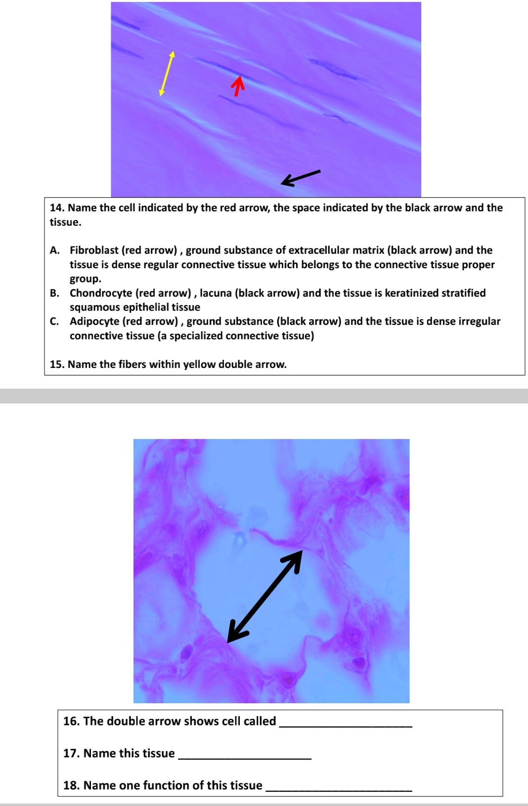 14. Name the cell indicated by the red arrow, the space indicated by the black arrow and the
tissue.
A. Fibroblast (red arrow), ground substance of extracellular matrix (black arrow) and the
tissue is dense regular connective tissue which belongs to the connective tissue proper
group.
B. Chondrocyte (red arrow), lacuna (black arrow) and the tissue is keratinized stratified
squamous epithelial tissue
C. Adipocyte (red arrow), ground substance (black arrow) and the tissue is dense irregular
connective tissue (a specialized connective tissue)
15. Name the fibers within yellow double arrow.
16. The double arrow shows cell called
17. Name this tissue
18. Name one function of this tissue
