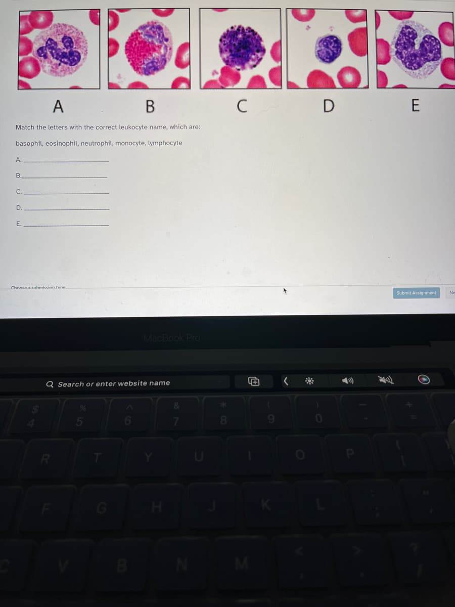 A
Match the letters with the correct leukocyte name, which are:
basophil, eosinophil, neutrophil, monocyte, lymphocyte
A.
B.
C.
D
E.
Choose a suhmiccion tune
$
R
B
Q Search or enter website name
5
6
MacBook Pro
H
&
7
N
8
C
9
D
0
E
Submit Assignment
Ne