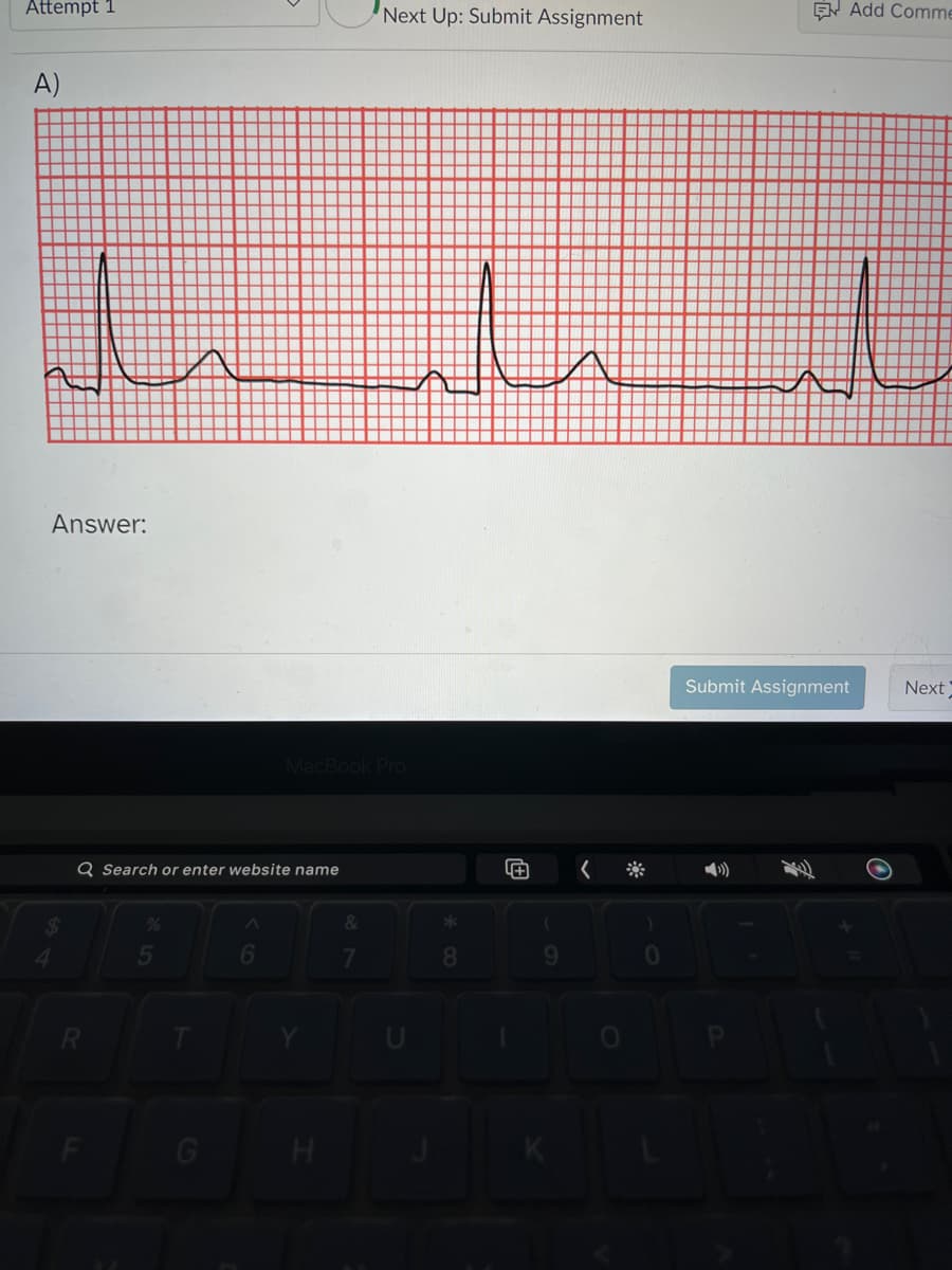 Attempt 1
A)
Answer:
$
Q Search or enter website name
R
F
5
6
MacBook Pro
H
&
Next Up: Submit Assignment
7
*
8
J
+
A
9
<
0
Add Comme
Submit Assignment
Next
