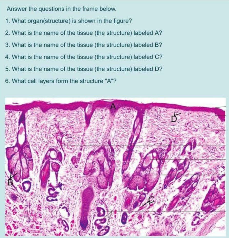 Answer the questions in the frame below.
1. What organ(structure) is shown in the figure?
2. What is the name of the tissue (the structure) labeled A?
3. What is the name of the tissue (the structure) labeled B?
4. What is the name of the tissue (the structure) labeled C?
5. What is the name of the tissue (the structure) labeled D?
6. What cell layers form the structure
"A"?
ABO
b