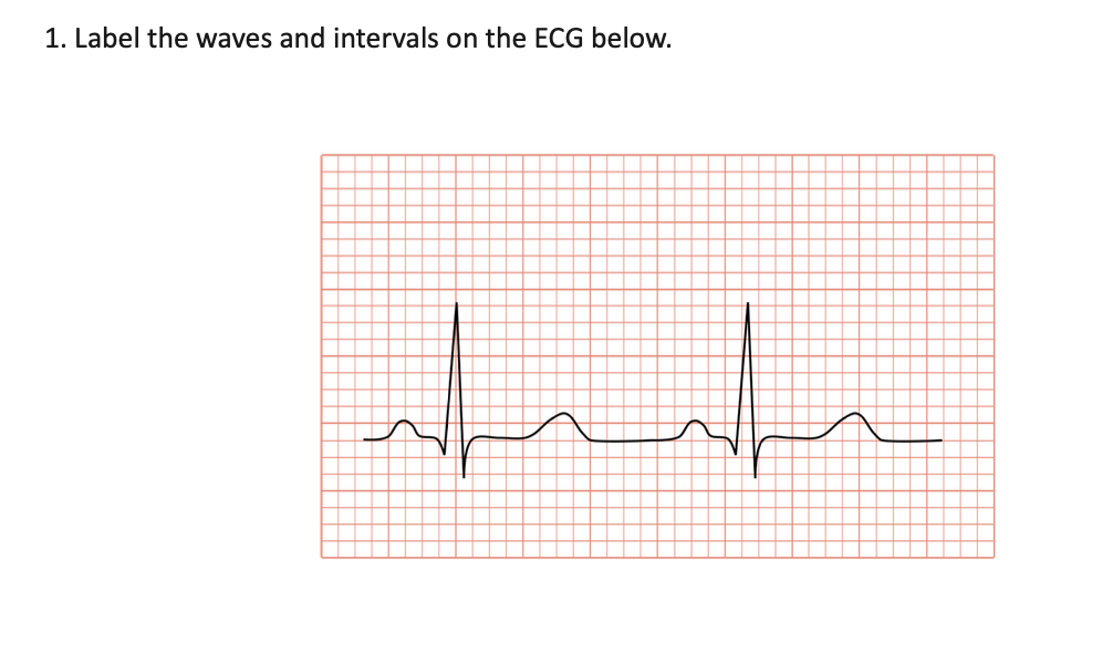 1. Label the waves and intervals on the ECG below.
