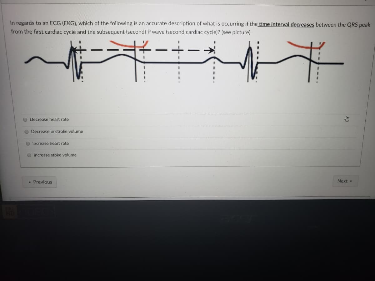 In regards to an ECG (EKG), which of the following is an accurate description of what is occurring if the time interval decreases between the QRS peak
from the first cardiac cycle and the subsequent (second) P wave (second cardiac cycle)? (see picture).
O Decrease heart rate
O Decrease in stroke volume
Increase heart rate
O Increase stoke volume
« Previous
Next
