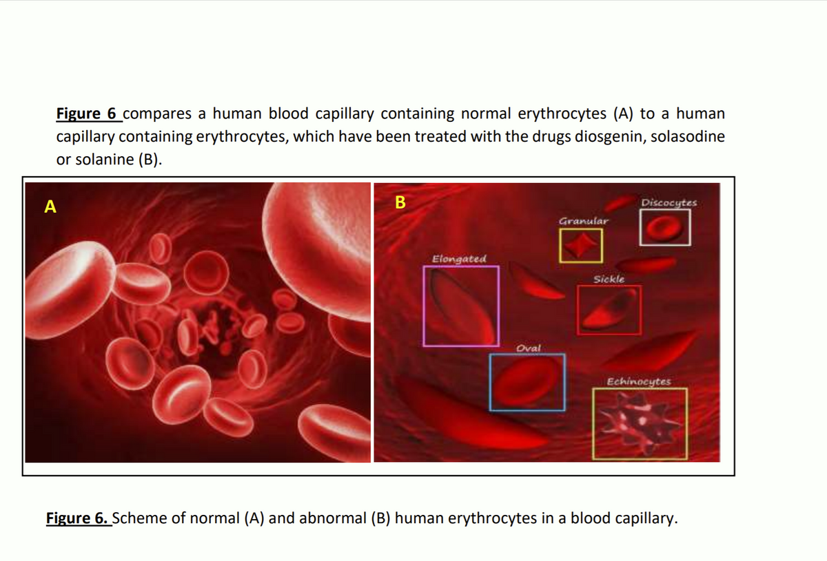 Figure 6 compares a human blood capillary containing normal erythrocytes (A) to a human
capillary containing erythrocytes, which have been treated with the drugs diosgenin, solasodine
or solanine (B).
A
Discocytes
Granular
Elongated
Sickle
Oval
Echinocytes
Figure 6. Scheme of normal (A) and abnormal (B) human erythrocytes in a blood capillary.

