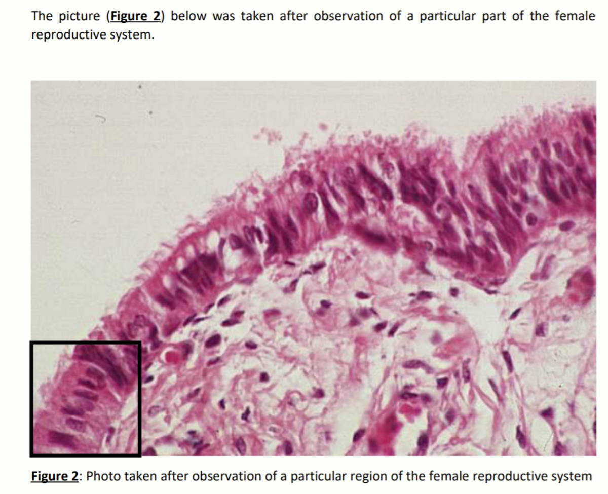 The picture (Figure 2) below was taken after observation of a particular part of the female
reproductive system.
Figure 2: Photo taken after observation of a particular region of the female reproductive system
