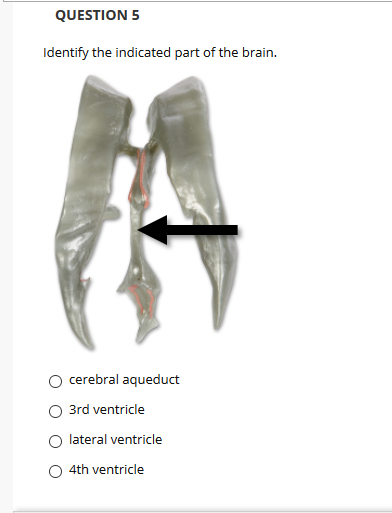 QUESTION 5
Identify the indicated part of the brain.
cerebral aqueduct
3rd ventricle
lateral ventricle
4th ventricle
