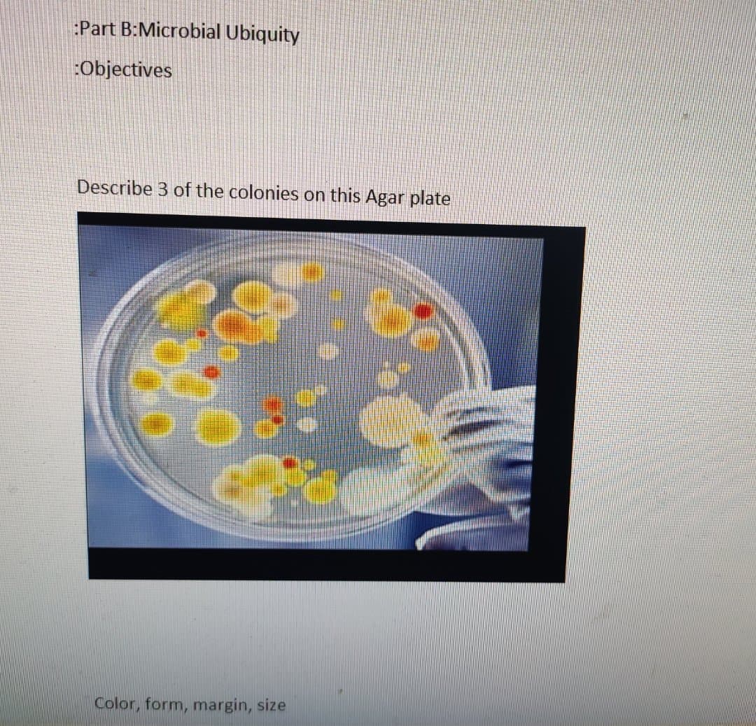:Part B:Microbial Ubiquity
:Objectives
Describe 3 of the colonies on this Agar plate
Color, form, margin, size
