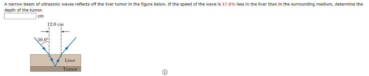 A narrow beam of ultrasonic waves reflects off the liver tumor in the figure below. If the speed of the wave is 17.8% less in the liver than in the surrounding medium, determine the
depth of the tumor.
cm
12.0 cm
50,0°l
Liver
Tumor
