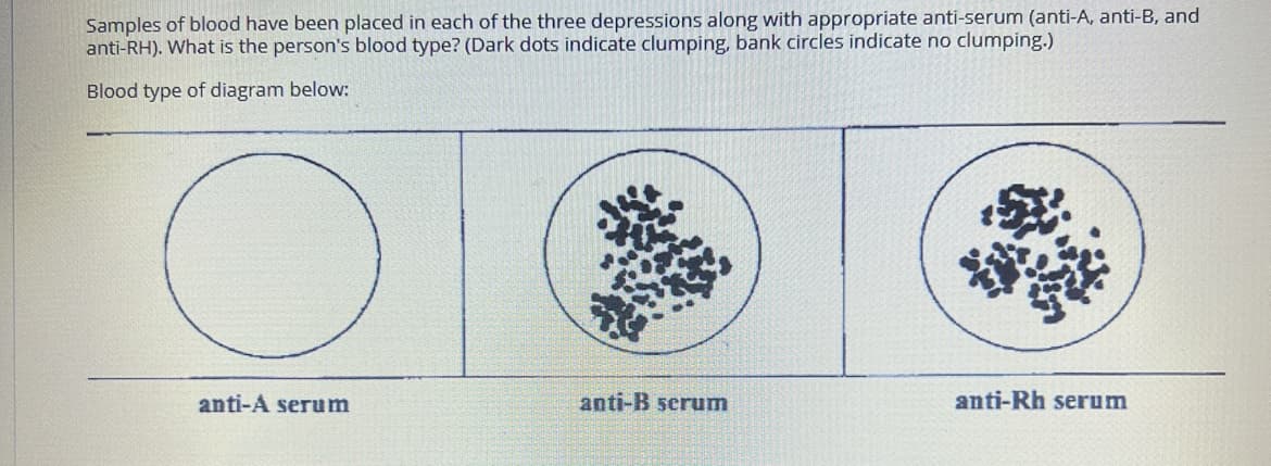 Samples of blood have been placed in each of the three depressions along with appropriate anti-serum (anti-A, anti-B, and
anti-RH). What is the person's blood type? (Dark dots indicate clumping, bank circles indicate no clumping.)
Blood type of diagram below:
anti-A serum
anti-B serum
anti-Rh serum
