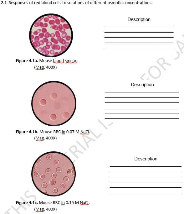 2.1 Responses of red blood cells to solutions of different osmotic concentrations.
Description
Figure 4.1a. Mouse blood smear.
wwwwwwwww
(Mag. 400x)
Figure 4.1b. Mouse RBC in 0.07 M NaCl.
(Mag. 400X)
RIAL
Mouse RBC in 0.15 M NaCl.
(Mag. 400X)
TOUTE
FOR SA
Description
Description