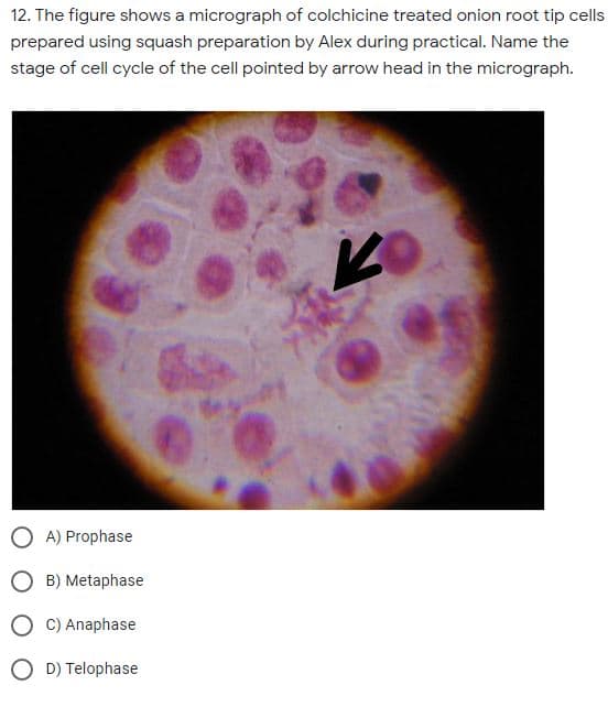 12. The figure shows a micrograph of colchicine treated onion root tip cells
prepared using squash preparation by Alex during practical. Name the
stage of cell cycle of the cell pointed by arrow head in the micrograph.
A) Prophase
B) Metaphase
C) Anaphase
O D) Telophase
