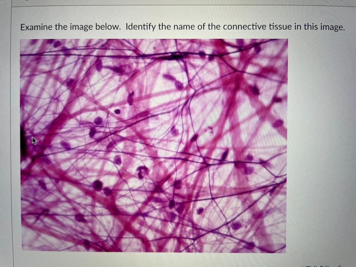 Examine the image below. Identify the name of the connective tissue in this image.
