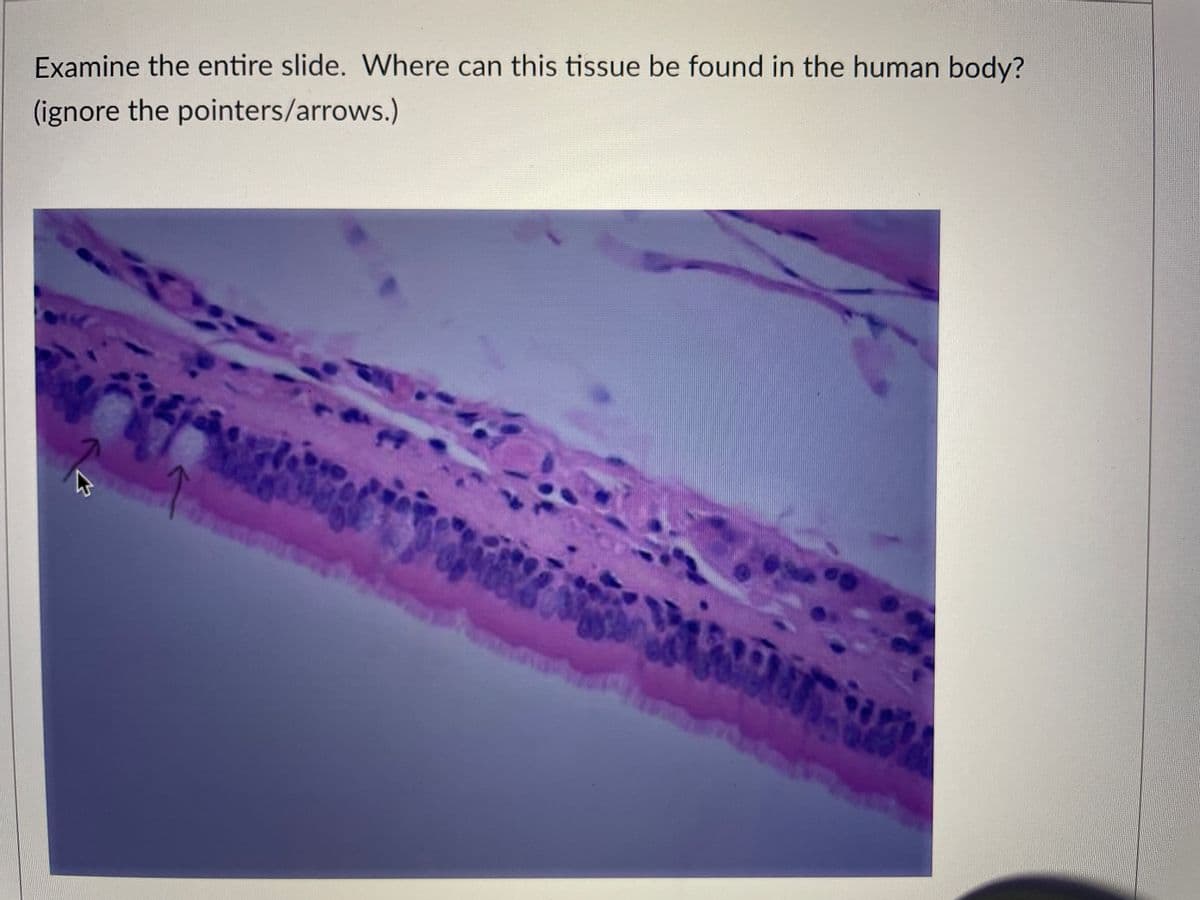 Examine the entire slide. Where can this tissue be found in the human body?
(ignore the pointers/arrows.)
