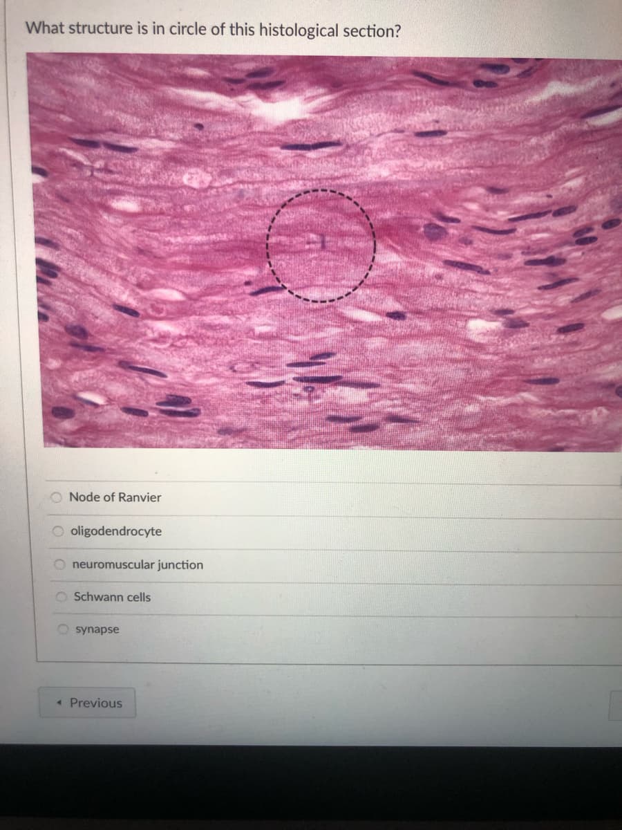 What structure is in circle of this histological section?
Node of Ranvier
oligodendrocyte
neuromuscular junction
O Schwann cells
Osynapse
< Previous