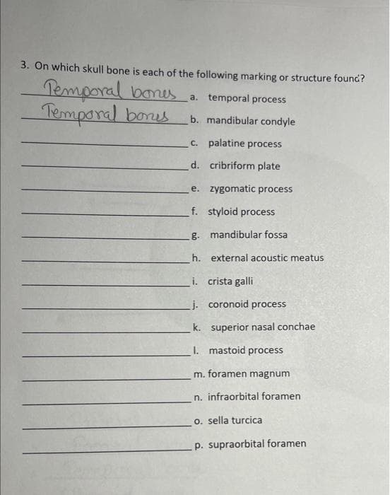 3. On which skull bone is each of the following marking or structure found?
Temporal bones a.
Temporal bonus
a. temporal process
b. mandibular condyle
c. palatine process
d.
cribriform plate
e.
zygomatic process
f.
styloid process
.g.
mandibular fossa
h.
external acoustic meatus
i. crista galli
j. coronoid process
k.
I. mastoid process
m. foramen magnum
n. infraorbital foramen
o. sella turcica
p. supraorbital foramen
superior nasal conchae