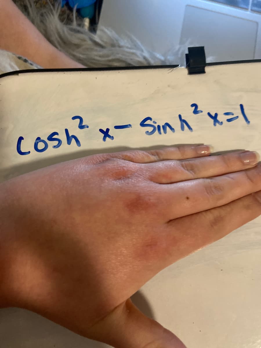 2.
Cosh'x- Sinァ、メー
- Sin A x=1
2.
