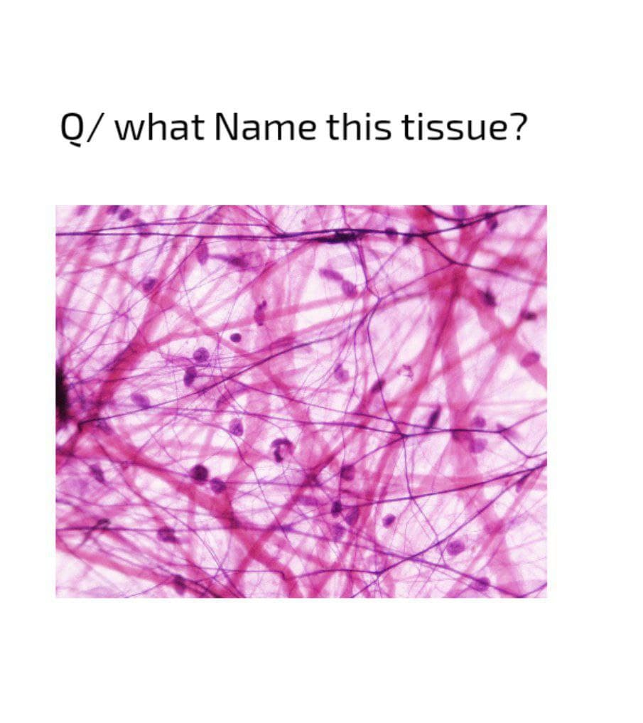 Q/ what Name this tissue?

