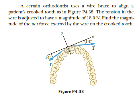 A certain orthodontist uses a wire brace to align a
patient's crooked tooth as in Figure P4.38. The tension in the
wire is adjusted to have a magnitude of 18.0 N. Find the magni-
tude of the net force exerted by the wire on the crooked tooth.
174
Figure P4.38
