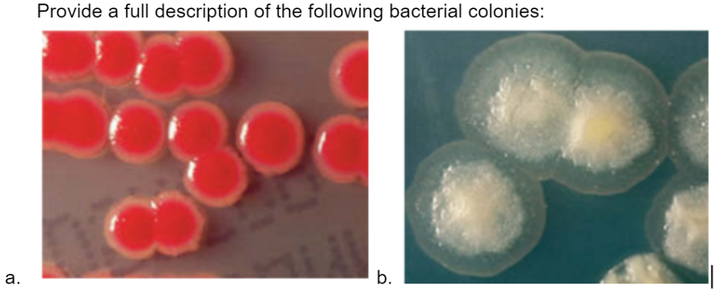 Provide a full description of the following bacterial colonies:
а.
b.

