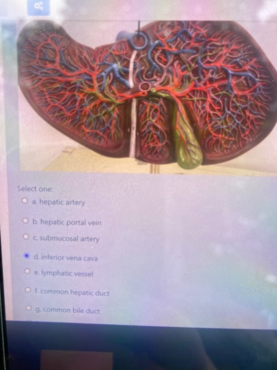 Select one:
O a. hepatic artery
O b. hepatic portal vein
Oc submucosal artery
O d. inferior vena cava
O e. lymphatic vessel
Of common hepatic duct
g. common bile duct
